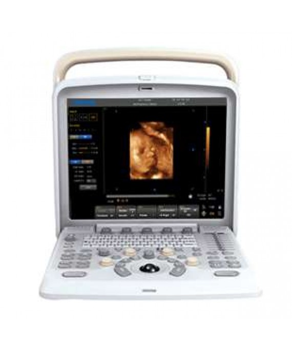 Q5  compact,multi-purpose ultrasound