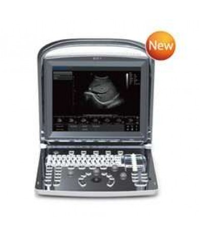 Ultrasound  CHISON ECO1 