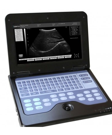 Ultrasound CHISON CMS600E